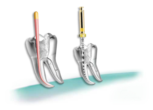 endodoncista exclusivo - clínica dental Sanlúcar Barrameda