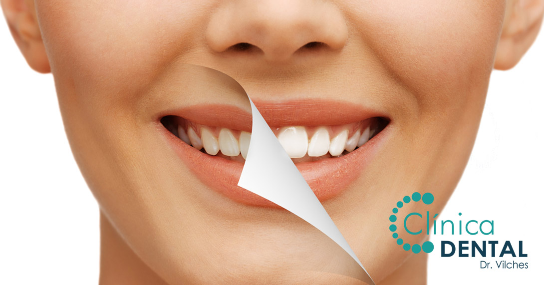 Estética dental Sanlúcar de Barrameda