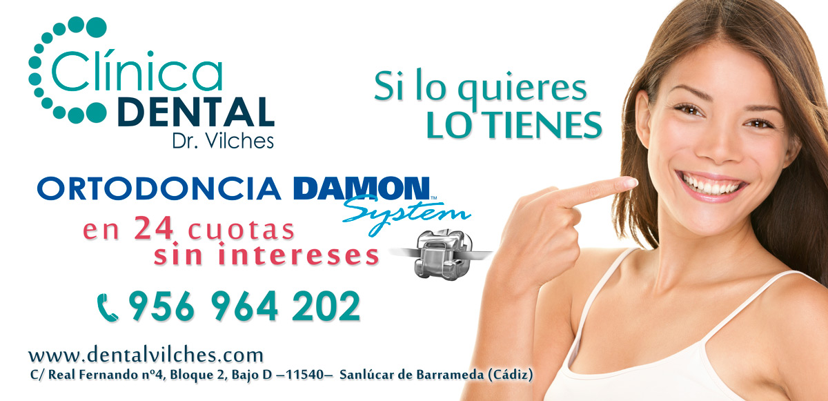 Ortodoncia Damon - Clínica dental Sanlúcar Barrameda
