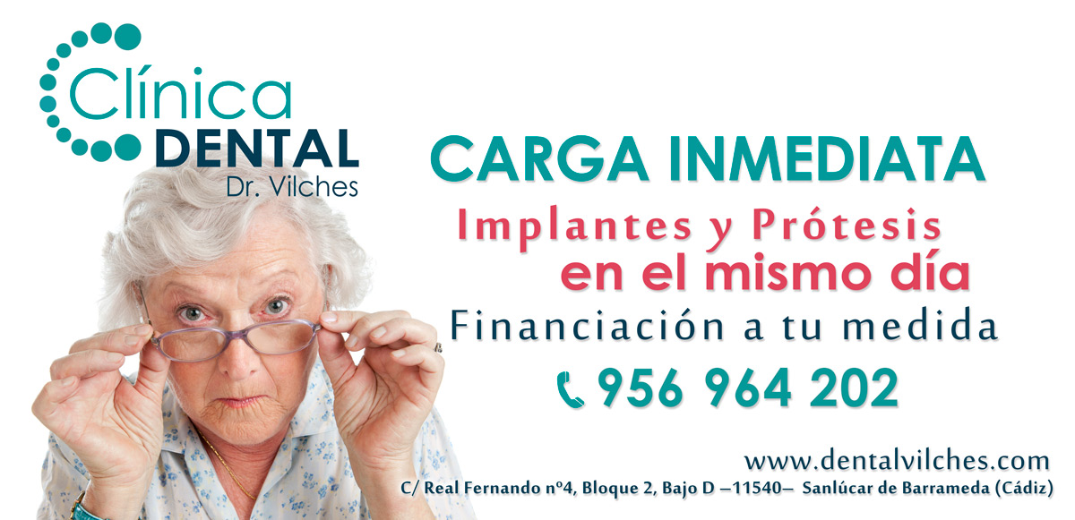 carga inmediata - Clínica dental Sanlúcar de Barrameda